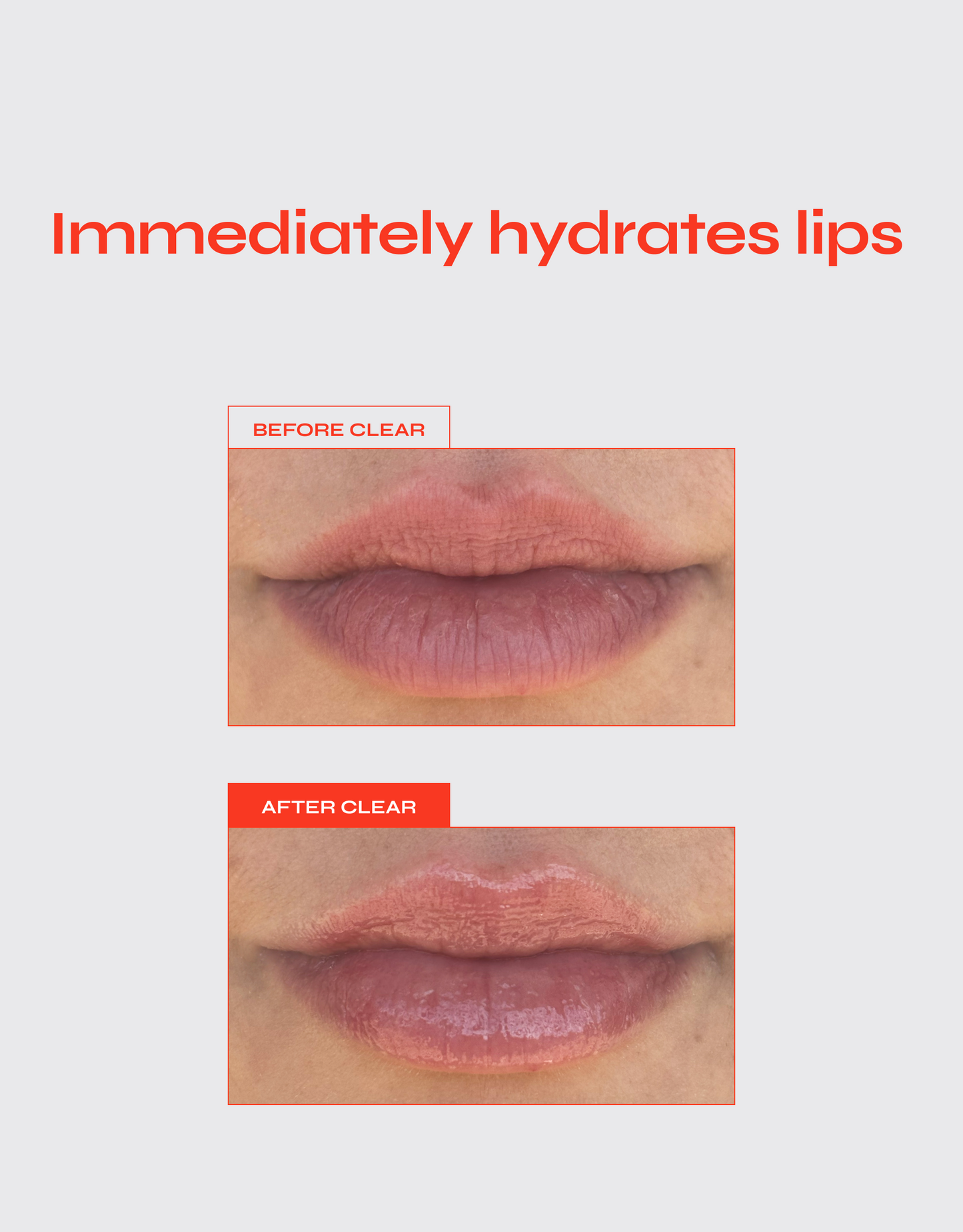 CLEAR LIP JELLY Hydrating Glossy Peptide Treatment