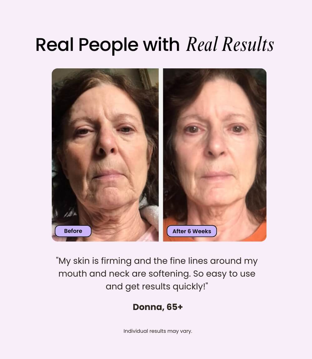 Velve Pro 5-in-1 Skincare Wand