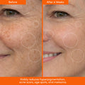 MANE SQUEEZE Tinted SPF + Dark Spot Serum Bundle