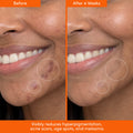 THE PLACENTA FACIAL Dark Spot Serum + Barrier Repair Cream Bundle