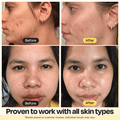 Vitamin C Clay Mask