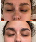 Eyebrow Regrowth Mask