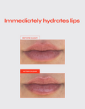Lip Jelly