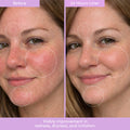 PEP TALK™ Bio-Peptide Barrier Repair Cream with Triple Lipid Complex