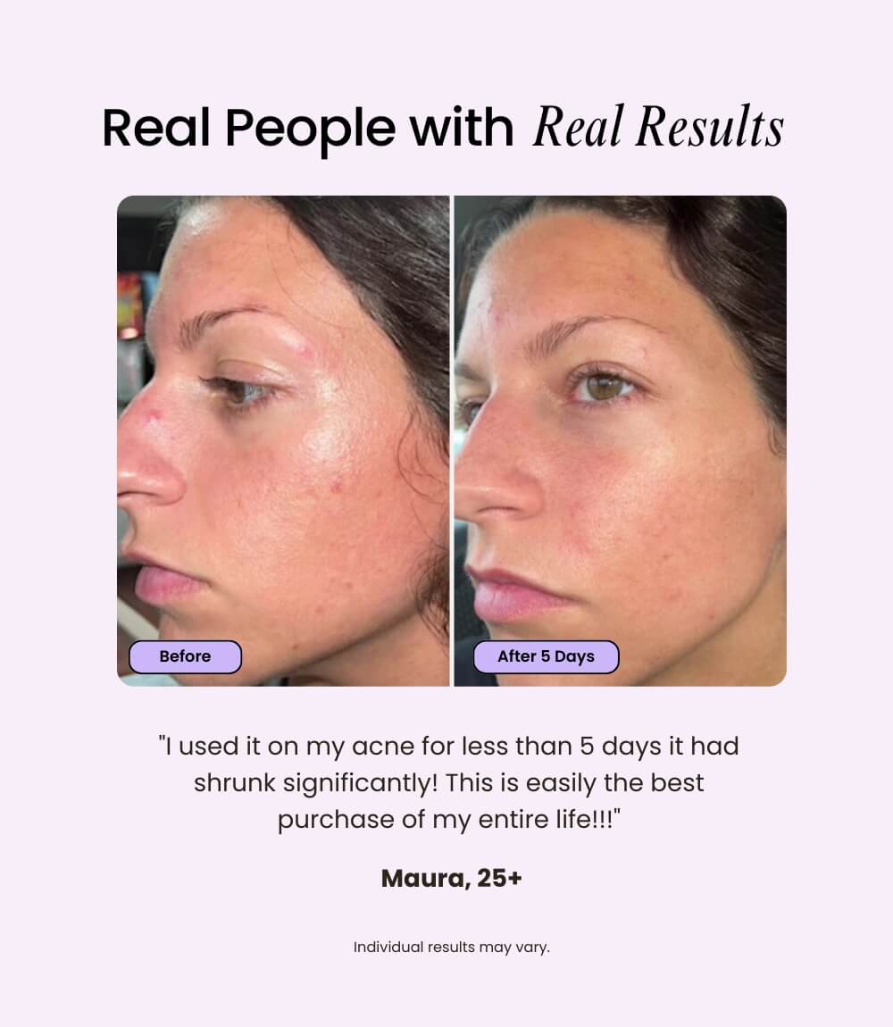 Velve Pro 5-in-1 Skincare Wand