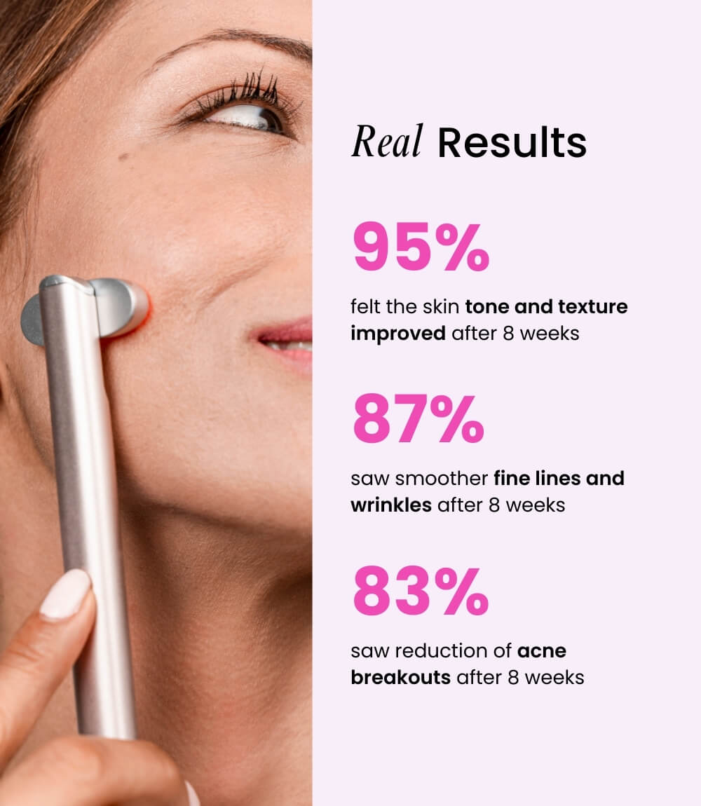 Velve Pro 5-in-1 Skincare Wand